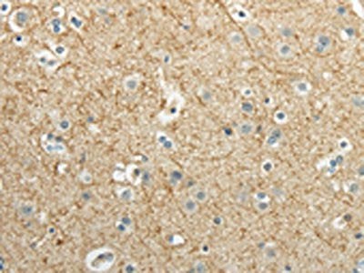 The image on the left is immunohistochemistry of paraffin-embedded Human brain tissue using the antibody Antibody) at dilution 1/40, on the right is treated with synthetic peptide. (Original magnification: ×200)Rabbit anti-Human WNT2 Polyclonal Antibody