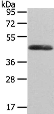 Gel: 8%SDS-PAGE, Lysate: 40 μg, Lane: Human endometrial cancer tissue, Primary antibody: WNT2 Antibody(WNT2 Antibody) at dilution 1/300 dilution, Secondary antibody: Goat anti rabbit IgG at 1/8000 dilution, Exposure time: 10 secondsRabbit anti-Human WNT2 Polyclonal Antibody