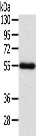 Gel: 8%SDS-PAGE, Lysate: 60 μg, Lane: Human placenta tissue, Primary antibody: SEPN1 Antibody(SEPN1 Antibody) at dilution 1/200, Secondary antibody: Goat anti rabbit IgG at 1/8000 dilution, Exposure time: 2 minutesRabbit anti-Human SEPN1 Polyclonal Antibody