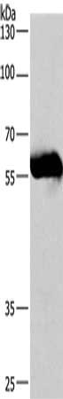 Gel: 8%SDS-PAGE, Lysate: 40 μg, Lane: Lovo cells, Primary antibody: CORO1C Antibody(CORO1C Antibody) at dilution 1/530, Secondary antibody: Goat anti rabbit IgG at 1/8000 dilution, Exposure time: 40 secondsRabbit anti-Human CORO1C Polyclonal Antibody