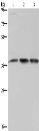 Gel: 8%SDS-PAGE, Lysate: 40 μg, Lane 1-3: 293T cells, LoVo cells, human brain malignant glioma tissue, Primary antibody: CAB39 Antibody(CAB39 Antibody) at dilution 1/450, Secondary antibody: Goat anti rabbit IgG at 1/8000 dilution, Exposure time: 5 seconds