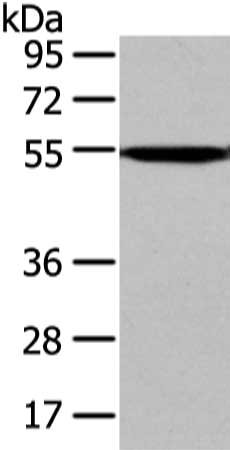 Gel: 8%SDS-PAGE, Lysate: 40 μg, Lane: Mouse liver tissue, Primary antibody: CAMK1G Antibody(CAMK1G Antibody) at dilution 1/250 dilution, Secondary antibody: Goat anti rabbit IgG at 1/8000 dilution, Exposure time: 1MIN
