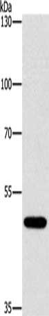 Gel: 8%SDS-PAGE, Lysate: 40 μg, Lane: Mouse brain tissue, Primary antibody: CTBP1 Antibody(CTBP1 Antibody) at dilution 1/400, Secondary antibody: Goat anti rabbit IgG at 1/8000 dilution, Exposure time: 10 minutesRabbit anti-Human CTBP1 Polyclonal Antibody