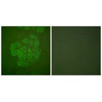 Immunofluorescence analysis of A549 cells, using GR (Ab-211) antibody.Rabbit anti-Human NR3C1 Polyclonal Antibody