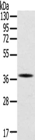 Gel: 8%SDS-PAGE, Lysate: 40 μg, Lane: A375 cells, Primary antibody: SPARC Antibody(SPARC Antibody) at dilution 1/400, Secondary antibody: Goat anti rabbit IgG at 1/8000 dilution, Exposure time: 5 secondsRabbit anti-Human SPARC Polyclonal Antibody