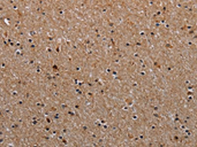 The image on the left is immunohistochemistry of paraffin-embedded Human brain  tissue using NDUFA8 Antibody(NDUFA8 Antibody) at dilution 1/40, on the right is treated with synthetic peptide. (Original magnification: ×200)Rabbit anti-Human NDUFA8 Polyclonal Antibody
