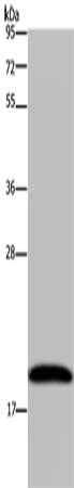 Gel: 10%SDS-PAGE, Lysate: 40 μg, Lane: 293T cells, Primary antibody: NDUFA8 Antibody(NDUFA8 Antibody) at dilution 1/300, Secondary antibody: Goat anti rabbit IgG at 1/8000 dilution, Exposure time: 1 minuteRabbit anti-Human NDUFA8 Polyclonal Antibody
