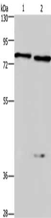 Gel: 8%SDS-PAGE, Lysate: 40 μg, Lane 1-2: Mouse brain tissue, Mouse kidney tissue, Primary antibody: COL4A3BP Antibody(COL4A3BP Antibody) at dilution 1/300, Secondary antibody: Goat anti rabbit IgG at 1/8000 dilution, Exposure time: 1 minuteRabbit anti-Human COL4A3BP Polyclonal Antibody