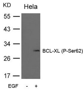 Western blot analysis of extracts from Hela cells untreated or treated with EGF using BCL-XL (Phospho-Ser62) Antibody.