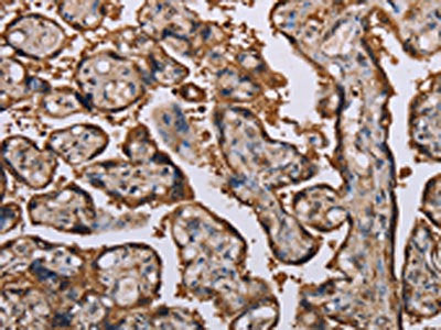 The image on the left is immunohistochemistry of paraffin-embedded Human placenta tissue using the antibody Antibody) at dilution 1/70, on the right is treated with fusion protein. (Original magnification: ×200)