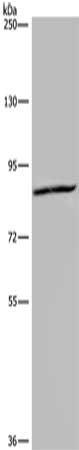 Gel: 6%SDS-PAGE, Lysate: 40 μg, Lane: Hela cells, Primary antibody: KIF2A Antibody(KIF2A Antibody) at dilution 1/350, Secondary antibody: Goat anti rabbit IgG at 1/8000 dilution, Exposure time: 20 seconds