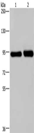 Gel: 6%SDS-PAGE, Lysate: 40 μg, Lane 1-2: Hela cells, A431 cells, Primary antibody: PMS2 Antibody(PMS2 Antibody) at dilution 1/200, Secondary antibody: Goat anti rabbit IgG at 1/8000 dilution, Exposure time: 2 minutesRabbit anti-Human PMS2 Polyclonal Antibody