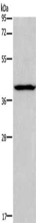Gel: 8%SDS-PAGE, Lysate: 40 μg, Lane: Human lymphoma tissue, Primary antibody: ARC Antibody(ARC Antibody) at dilution 1/200, Secondary antibody: Goat anti rabbit IgG at 1/8000 dilution, Exposure time: 10 secondsRabbit anti-Human ARC Polyclonal Antibody