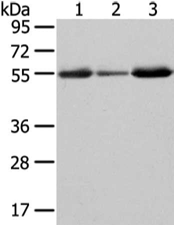 Gel: 8%SDS-PAGE, Lysate: 40 μg, Lane 1-3: Human thyroid cancer and liver cancer tissue, human fetal intestines tissue, Primary antibody: XKRX Antibody(XKRX Antibody) at dilution 1/500 dilution, Secondary antibody: Goat anti rabbit IgG at 1/8000 dilution, Exposure time: 2 minutesRabbit anti-Human XKRX Polyclonal Antibody