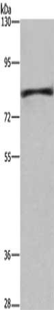 Gel: 6%SDS-PAGE, Lysate: 40 μg, Lane: Mouse liver tissue, Primary antibody: EHHADH Antibody(EHHADH Antibody) at dilution 1/250, Secondary antibody: Goat anti rabbit IgG at 1/8000 dilution, Exposure time: 2 minutesRabbit anti-Human EHHADH Polyclonal Antibody