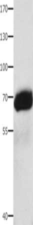 Gel: 8%SDS-PAGE, Lysate: 40 μg, Lane: Human liver cancer tissue, Primary antibody: AFP Antibody(AFP Antibody) at dilution 1/1000, Secondary antibody: Goat anti rabbit IgG at 1/8000 dilution, Exposure time: 30 secondsRabbit anti-Human AFP Polyclonal Antibody