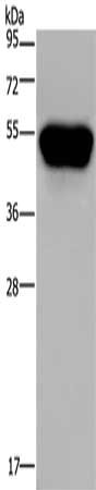 Gel: 10%SDS-PAGE, Lysate: 40 μg, Lane: Hela cells, Primary antibody: CD160 Antibody(CD160 Antibody) at dilution 1/250, Secondary antibody: Goat anti rabbit IgG at 1/8000 dilution, Exposure time: 40 secondsRabbit anti-Human CD160 Polyclonal Antibody