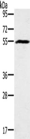 Gel: 8%SDS-PAGE, Lysate: 40 μg, Lane: Mouse heart tissue, Primary antibody: BMP6 Antibody(BMP6 Antibody) at dilution 1/500, Secondary antibody: Goat anti rabbit IgG at 1/8000 dilution, Exposure time: 10 seconds