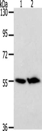 Gel: 8%SDS-PAGE, Lysate: 40 μg, Lane 1-2: Mouse kidney tissue, Mouse liver tissue, Primary antibody: ACOT2 Antibody(ACOT2 Antibody) at dilution 1/200, Secondary antibody: Goat anti rabbit IgG at 1/8000 dilution, Exposure time: 5 minutes
