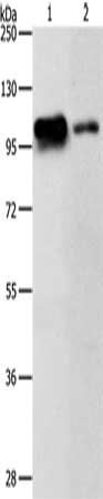 Gel: 8%SDS-PAGE, Lysate: 40 μg, Lane 1-2: Jurkat cells, 293T cells, Primary antibody: KDM1A Antibody(KDM1A Antibody) at dilution 1/500, Secondary antibody: Goat anti rabbit IgG at 1/8000 dilution, Exposure time: 1 minute