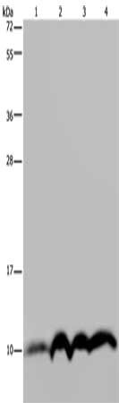 Gel: 10%SDS-PAGE, Lysate: 40 μg, Lane 1-4: SKOV3 cells, human fetal liver tissue, human fetal brain tissue, Hela cells, Primary antibody: NDUFA4 Antibody(NDUFA4 Antibody) at dilution 1/300, Secondary antibody: Goat anti rabbit IgG at 1/8000 dilution, Exposure time: 20 secondsRabbit anti-Human NDUFA4 Polyclonal Antibody