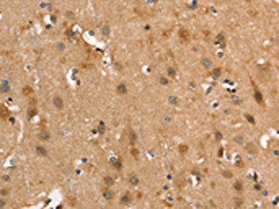 The image on the left is immunohistochemistry of paraffin-embedded Human brain  tissue using CALCRL Antibody(CALCRL Antibody) at dilution 1/40, on the right is treated with synthetic peptide. (Original magnification: ×200)Rabbit anti-Human CALCRL Polyclonal Antibody