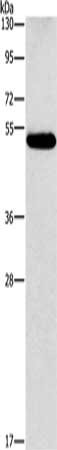 Gel: 8%SDS-PAGE, Lysate: 40 μg, Lane: Human lung cancer tissue, Primary antibody: CALCRL Antibody(CALCRL Antibody) at dilution 1/550, Secondary antibody: Goat anti rabbit IgG at 1/8000 dilution, Exposure time: 40 secondsRabbit anti-Human CALCRL Polyclonal Antibody