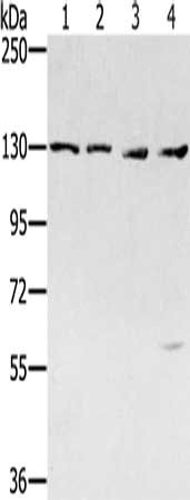 Gel: 6%SDS-PAGE, Lysate: 40 μg, Lane 1-4: Jurkat cells, 231 cells, hela cells, 293T cells, Primary antibody: SMC6 Antibody(SMC6 Antibody) at dilution 1/250, Secondary antibody: Goat anti rabbit IgG at 1/8000 dilution, Exposure time: 2 minutesRabbit anti-Human SMC6 Polyclonal Antibody