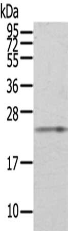 Gel: 6%SDS-PAGE,Lysate: 40 μg,,Primary antibody: RAB8A Antibody(RAB8A Antibody) at dilution 1/200 dilution,Secondary antibody: Goat anti rabbit IgG at 1/8000 dilution,Exposure time: 40 secondsRabbit anti-Human RAB8A Polyclonal Antibody