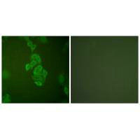 Immunofluorescence analysis of A549 cells, using NSE antibody.Rabbit anti-Human ENO2 Polyclonal Antibody
