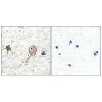 Immunohistochemical analysis of paraffin-embedded human brain tissue using NSE antibody.Rabbit anti-Human ENO2 Polyclonal Antibody