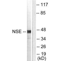 Western blot analysis of extracts from HepG2 cells, using NSE antibody.Rabbit anti-Human ENO2 Polyclonal Antibody