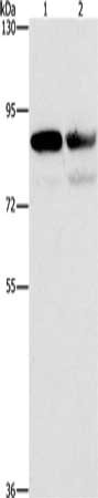 Gel: 6%SDS-PAGE, Lysate: 40 μg, Lane 1-2: A431 cells, Raji cells, Primary antibody: CD2AP Antibody(CD2AP Antibody) at dilution 1/1000, Secondary antibody: Goat anti rabbit IgG at 1/8000 dilution, Exposure time: 1 secondRabbit anti-Human CD2AP Polyclonal Antibody
