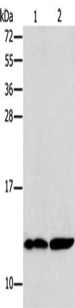 Gel: 15%SDS-PAGE, Lysate: 40 μg, Lane 1-2: Human kidney tissue, Raji cells, Primary antibody: B2M Antibody(B2M Antibody) at dilution 1/250, Secondary antibody: Goat anti rabbit IgG at 1/8000 dilution, Exposure time: 20 secondsRabbit anti-Human B2M Polyclonal Antibody