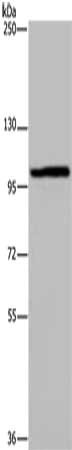 Gel: 6%SDS-PAGE, Lysate: 40 μg, Lane: LO2 cells, Primary antibody: MAP3K11 Antibody(MAP3K11 Antibody) at dilution 1/400, Secondary antibody: Goat anti rabbit IgG at 1/8000 dilution, Exposure time: 40 seconds