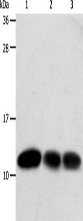 Gel: 12%SDS-PAGE, Lysate: 40 μg, Lane 1-3: Hela cells, MCF7 cells, human liver cancer tissue, Primary antibody: TXN Antibody(TXN Antibody) at dilution 1/600, Secondary antibody: Goat anti rabbit IgG at 1/8000 dilution, Exposure time: 20 secondsRabbit anti-Human TXN Polyclonal Antibody