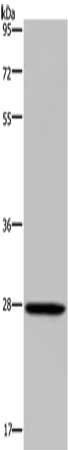 Gel: 8%SDS-PAGE, Lysate: 40 μg, Lane: Mouse spleen tissue, Primary antibody: KLK14 Antibody(KLK14 Antibody) at dilution 1/300, Secondary antibody: Goat anti rabbit IgG at 1/8000 dilution, Exposure time: 3 minutesRabbit anti-Human KLK14 Polyclonal Antibody
