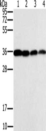 Gel: 10%SDS-PAGE, Lysate: 40 μg, Lane 1-4: Raji cells, Jurkat cells, 293T cells, hela cells, Primary antibody: CENPV Antibody(CENPV Antibody) at dilution 1/200, Secondary antibody: Goat anti rabbit IgG at 1/8000 dilution, Exposure time: 1 secondRabbit anti-Human CENPV Polyclonal Antibody