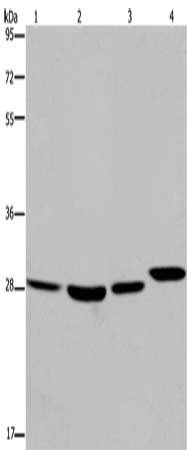 Gel: 8%SDS-PAGE, Lysate: 40 μg, Lane 1-4: 293T cells, LoVo cells, mouse skin tissue, A172 cells, Primary antibody: ETV7 Antibody(ETV7 Antibody) at dilution 1/850, Secondary antibody: Goat anti rabbit IgG at 1/8000 dilution, Exposure time: 30 secondsRabbit anti-Human ETV7 Polyclonal Antibody