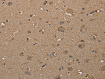 The image on the left is immunohistochemistry of paraffin-embedded Human brain tissue using the antibody Antibody) at dilution 1/40, on the right is treated with synthetic peptide. (Original magnification: ×200)