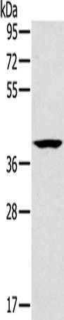 Gel: 8%SDS-PAGE, Lysate: 40 μg, Lane: Lovo cells, Primary antibody: CAB39 Antibody(CAB39 Antibody) at dilution 1/200, Secondary antibody: Goat anti rabbit IgG at 1/8000 dilution, Exposure time: 20 seconds