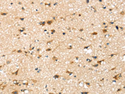 The image on the left is immunohistochemistry of paraffin-embedded Human brain tissue using SRPX Antibody(SRPX Antibody) at dilution 1/30, on the right is treated with fusion protein. (Original magnification: X200)Rabbit anti-Human SRPX Polyclonal Antibody