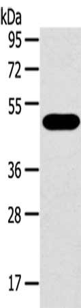 Gel: 8%SDS-PAGE,Lysate: 40μg,Primary antibody: SRPX Antibody(SRPX Antibody) at dilution 1/500 dilution,Secondary antibody: Goat anti rabbit IgG at 1/8000 dilution,Exposure time: 15 secondsRabbit anti-Human SRPX Polyclonal Antibody