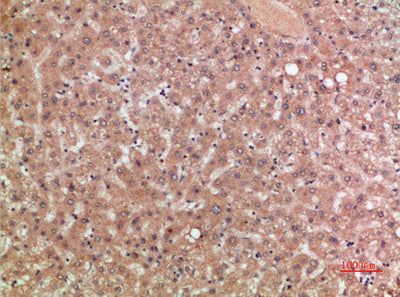 Immunohistochemical analysis of paraffin-embedded human-liver, antibody was diluted at 1:200Rabbit anti-Human CCR5 Polyclonal Antibody