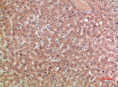 Immunohistochemical analysis of paraffin-embedded human-liver, antibody was diluted at 1:200Rabbit anti-Human CCR5 Polyclonal Antibody