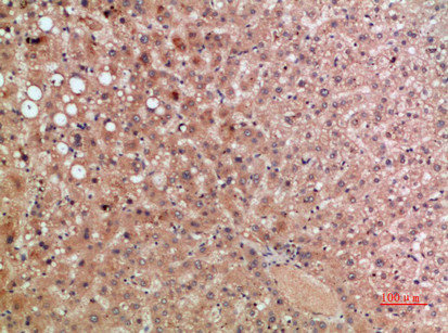 Immunohistochemical analysis of paraffin-embedded human-liver, antibody was diluted at 1:200Rabbit anti-Human CCR5 Polyclonal Antibody