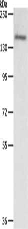 Gel: 8%SDS-PAGE, Lysate: 40 μg, Lane: Hela cells, Primary antibody: PTCH1 Antibody(PTCH1 Antibody) at dilution 1/650, Secondary antibody: Goat anti rabbit IgG at 1/8000 dilution, Exposure time: 2 minutesRabbit anti-Human PTCH1 Polyclonal Antibody