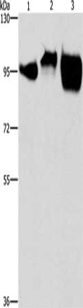 Gel: 6%SDS-PAGE, Lysate: 40 μg, Lane 1-3: Huvec cells, hela cells, raji cells, Primary antibody: ICAM1 Antibody(ICAM1 Antibody) at dilution 1/500, Secondary antibody: Goat anti rabbit IgG at 1/8000 dilution, Exposure time: 30 secondsRabbit anti-Human ICAM1 Polyclonal Antibody