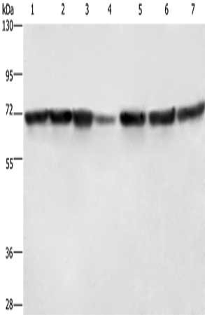 Gel: 6%SDS-PAGE, Lysate: 40 μg, Lane 1-7: Hela cells, HT29 cells, human fetal liver tissue, Human testis tissue, 231 cells, K562 cells, human bladder transitional cell carcinoma tissue, Primary antibody: LMNB1 Antibody(LMNB1 Antibody) at dilution 1/750, Secondary antibody: Goat anti rabbit IgG at 1/8000 dilution, Exposure time: 1 second