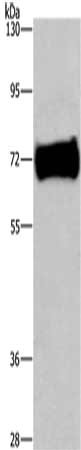 Gel: 6%SDS-PAGE, Lysate: 40 μg, Lane: Mouse kidney tissue, Primary antibody: EZR Antibody(EZR Antibody) at dilution 1/200, Secondary antibody: Goat anti rabbit IgG at 1/8000 dilution, Exposure time: 30 secondsRabbit anti-Human EZR Polyclonal Antibody